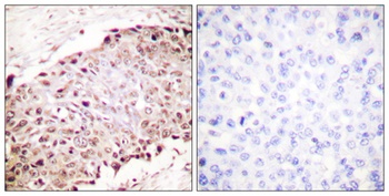 SUMO-1 rabbit pAb Antibody