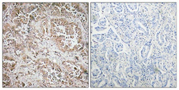 Synphilin-1 rabbit pAb Antibody