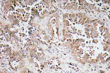 Synphilin-1 rabbit pAb Antibody