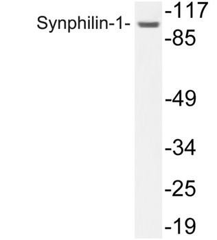 Synphilin-1 rabbit pAb Antibody