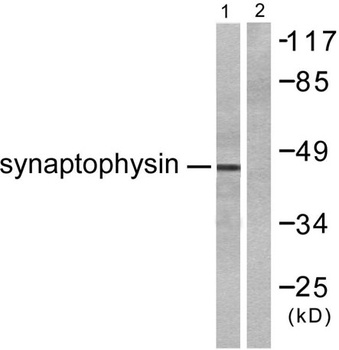 SYP rabbit pAb Antibody