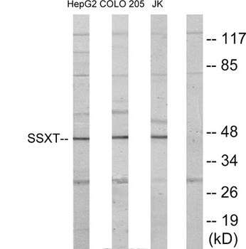 SYT rabbit pAb Antibody