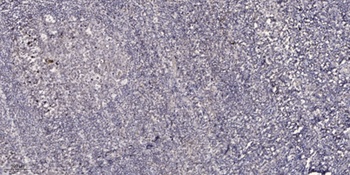 SYT rabbit pAb Antibody