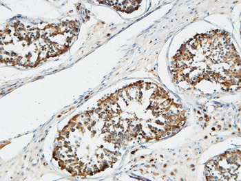 TACC3 rabbit pAb Antibody