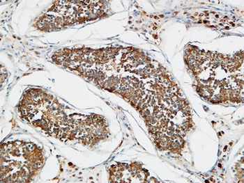 TACC3 rabbit pAb Antibody