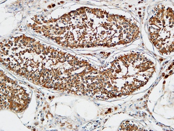 TACC3 rabbit pAb Antibody