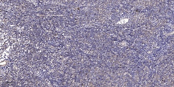 TCF-4/12 rabbit pAb Antibody
