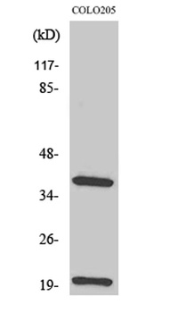 TCR β rabbit pAb Antibody