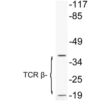 TCR β rabbit pAb Antibody