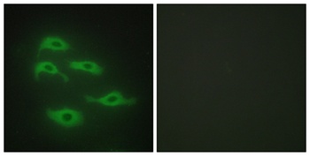 TDE1 rabbit pAb Antibody