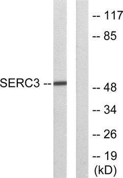 TDE1 rabbit pAb Antibody
