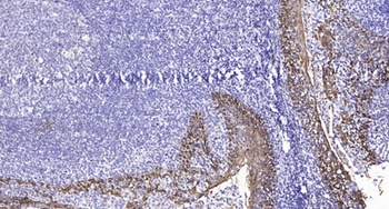 TDE1 rabbit pAb Antibody