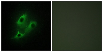 TDE2L rabbit pAb Antibody