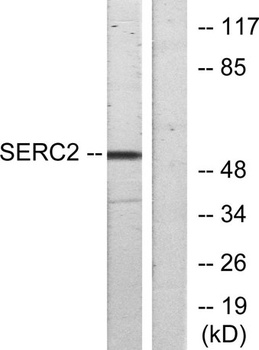TDE2L rabbit pAb Antibody