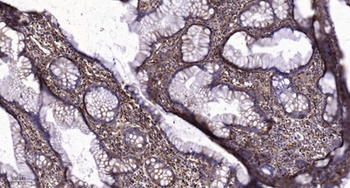 TDE2L rabbit pAb Antibody