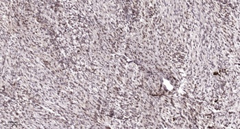 TEL rabbit pAb Antibody