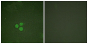 TFDP1 rabbit pAb Antibody
