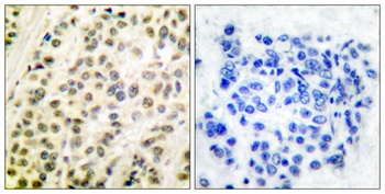 TFDP1 rabbit pAb Antibody