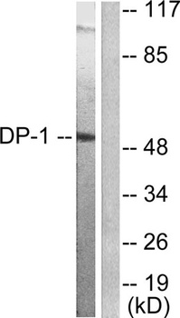 TFDP1 rabbit pAb Antibody