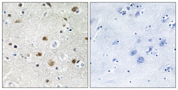 TFIIIB90-1 rabbit pAb Antibody