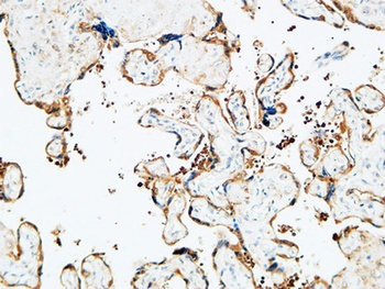 TGase2 rabbit pAb Antibody