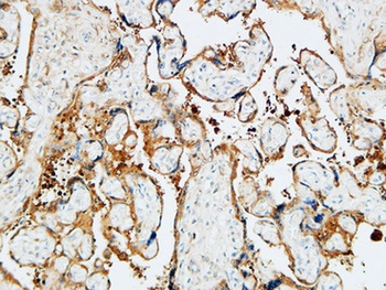TGase2 rabbit pAb Antibody