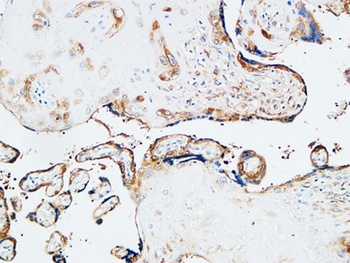 TGase2 rabbit pAb Antibody