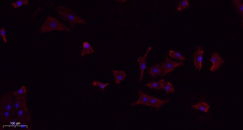 TGFβ1 rabbit pAb Antibody