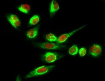 Tyrosine Hydroxylase rabbit pAb