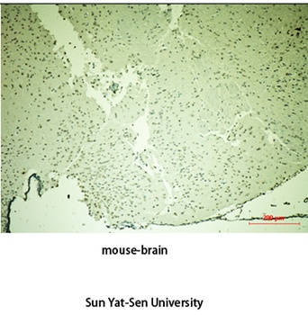 Tyrosine Hydroxylase rabbit pAb