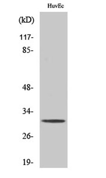 TIMP-3 rabbit pAb Antibody
