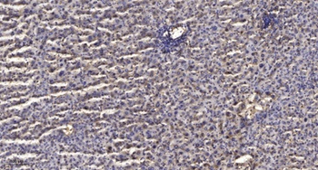 TIMP-3 rabbit pAb Antibody