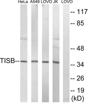TIS11B rabbit pAb Antibody