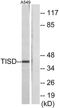 TIS11D rabbit pAb Antibody