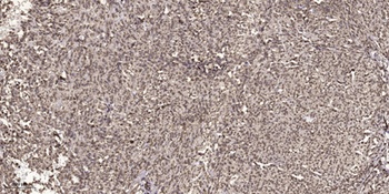 TIS11D rabbit pAb Antibody