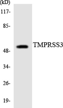 TMPRSS3 rabbit pAb Antibody