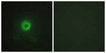 TNF-R2 rabbit pAb Antibody