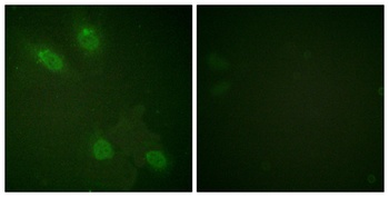 TRAP220 rabbit pAb Antibody
