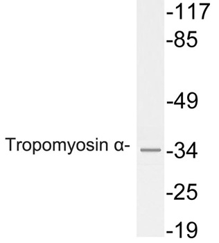 Tropomyosin α rabbit pAb Antibody