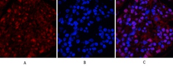 Tubulin β rabbit pAb Antibody