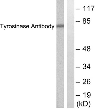 TYR rabbit pAb Antibody