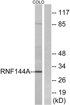 UBCE7IP4 rabbit pAb Antibody