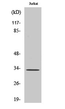 UCP3 rabbit pAb Antibody