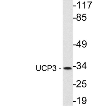 UCP3 rabbit pAb Antibody