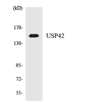 USP42 rabbit pAb Antibody