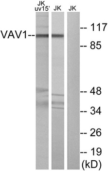 Vav1 rabbit pAb Antibody