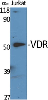 VDR rabbit pAb Antibody