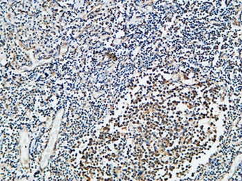VDR rabbit pAb Antibody