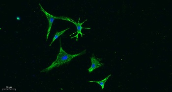 Vinculin rabbit pAb Antibody