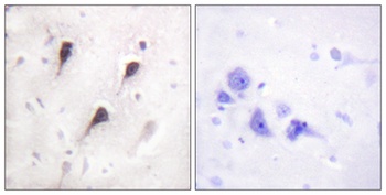 WAVE1 rabbit pAb Antibody